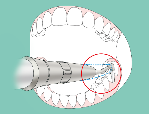 Slim Nozzle